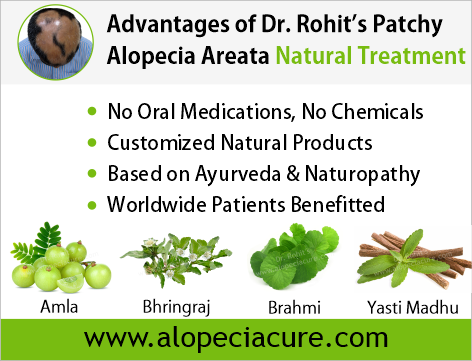 Advantages of Dr. Rohit's Alopecia Areata Natural Treatment